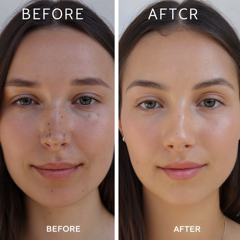 Before and After